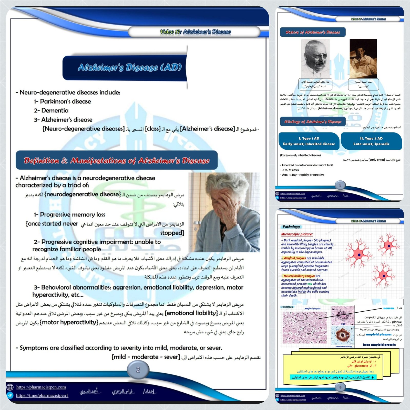 تفريغات الفيديو الثاني عشر 12 دكتور فوده Alzheimer’s Diseasr شابتر CNS